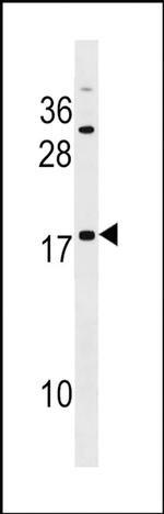 SPANXC Antibody in Western Blot (WB)