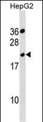 TMPRSS11BNL Antibody in Western Blot (WB)
