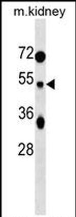 TUFT1 Antibody in Western Blot (WB)