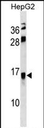 RELM beta Antibody in Western Blot (WB)