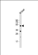 STK38 Antibody in Western Blot (WB)