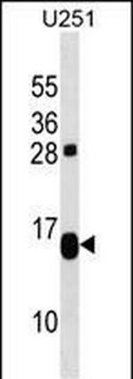 TP53TG1 Antibody in Western Blot (WB)