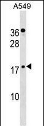 ZNF663P Polyclonal Antibody