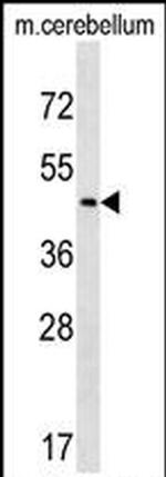 CHST2 Antibody in Western Blot (WB)