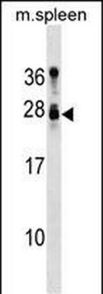 TUSC1 Antibody in Western Blot (WB)