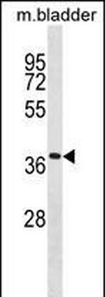 TMEM158 Polyclonal Antibody