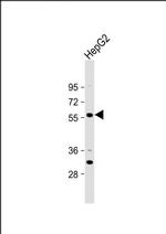 ST6GAL2 Antibody in Western Blot (WB)