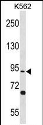 TSGA10 Antibody in Western Blot (WB)