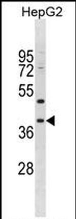 MPPED1 Antibody in Western Blot (WB)