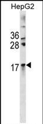 Alpha A Crystallin Antibody in Western Blot (WB)