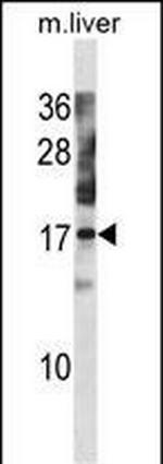 NXT1 Antibody in Western Blot (WB)