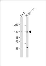 ENPP1 Antibody in Western Blot (WB)