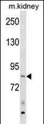 ARHGEF16 Polyclonal Antibody