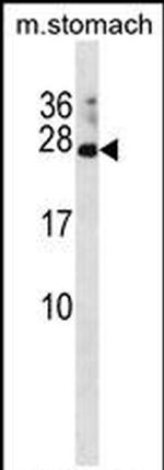 RAP2C Antibody in Western Blot (WB)