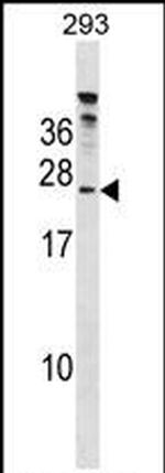 HTATSF1 Antibody in Western Blot (WB)