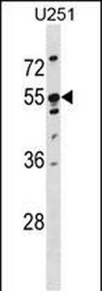KRT86 Polyclonal Antibody