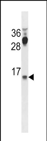 CYYR1 Antibody in Western Blot (WB)