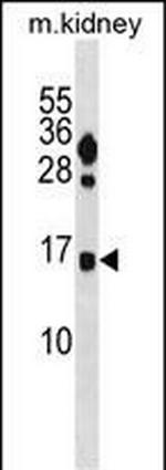 FUNDC2 Antibody in Western Blot (WB)