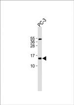 FUNDC2 Polyclonal Antibody