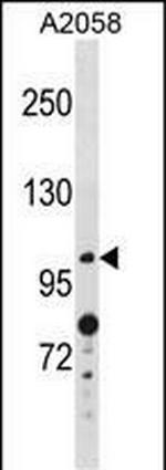 ANO4 Polyclonal Antibody