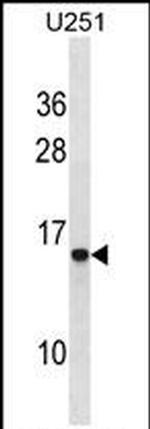 HPa1 Antibody in Western Blot (WB)