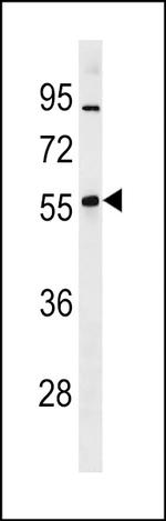ZNF260 Polyclonal Antibody