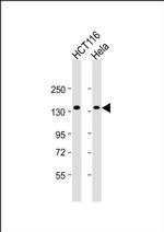 ANKS1 Antibody in Western Blot (WB)