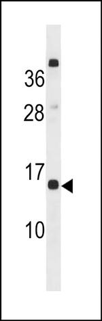 CLEC19A Polyclonal Antibody