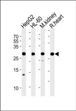 ATP Synthase B1 Antibody in Western Blot (WB)