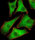 PSMD10 Antibody in Immunocytochemistry (ICC/IF)