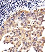 PSMD10 Antibody in Immunohistochemistry (IHC)