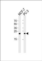 PSMD10 Antibody in Western Blot (WB)