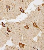 EEF1B2 Antibody in Immunohistochemistry (IHC)