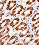 Cytochrome C1 Antibody in Immunohistochemistry (Paraffin) (IHC (P))
