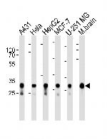 Cytochrome C1 Antibody in Western Blot (WB)