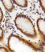 CHML Antibody in Immunohistochemistry (IHC)