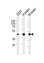 LYK5 Antibody in Western Blot (WB)