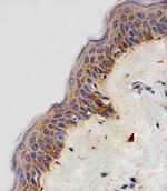 NDUFB4 Antibody in Immunohistochemistry (IHC)