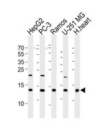 NDUFB4 Antibody in Western Blot (WB)