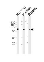 CNDP1 Antibody in Western Blot (WB)