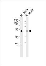 PIP4K2C Antibody in Western Blot (WB)