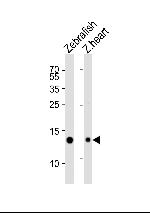 FABP10A Polyclonal Antibody