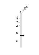 FABP10A Polyclonal Antibody