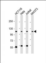 PRP6 Antibody in Western Blot (WB)