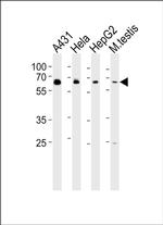 EHD4 Antibody in Western Blot (WB)
