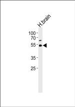 TRIM43B Antibody in Western Blot (WB)