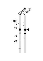 CHRNB3 Antibody in Western Blot (WB)