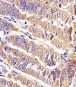 ROR2 Antibody in Immunohistochemistry (IHC)