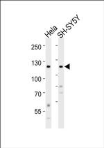 ROR2 Antibody in Western Blot (WB)