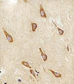 LIS1 Antibody in Immunohistochemistry (IHC)